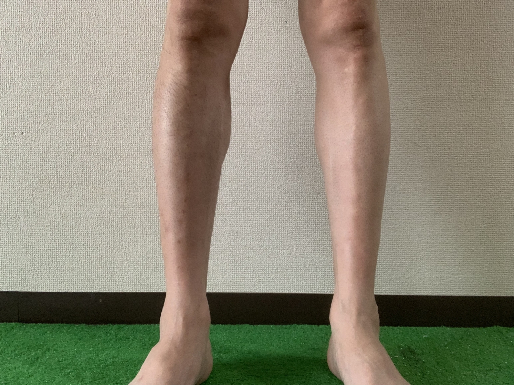 綺麗　ー第2章ー